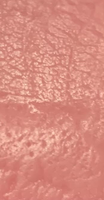Bubble Gum